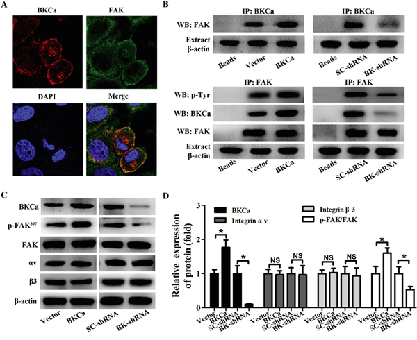 Modulation of FAK phosphorylation in PC3 cells by BKCa/&#x03B1;v&#x03B2;3 complex.