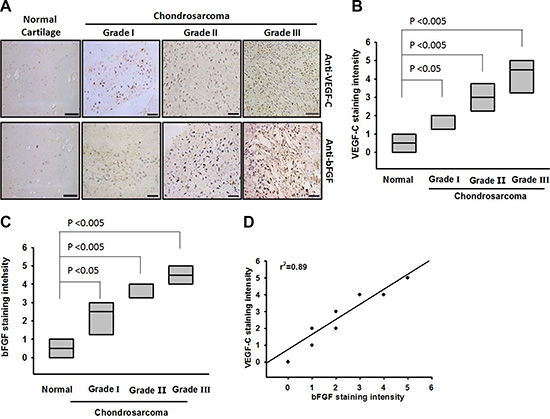 Clinical significance of bFGF and VEGF-C in specimens from patients with chondrosarcoma.