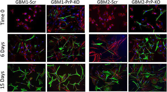 Immunofluorescence analysis of GFAP expression (green) at time 0, after 6 and 15 days of differentiation in medium containing 10% FBS.