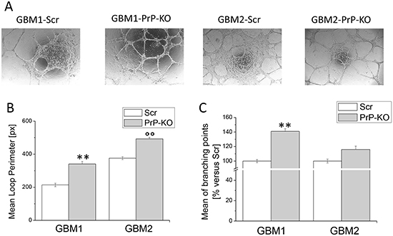 Effect of PrPC down-regulation on the ability of GBM CSCs to form endothelial tubes.