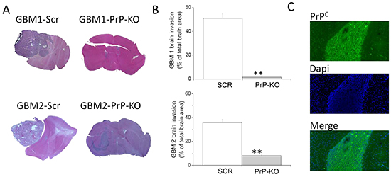 Role of PrPC in the in vivo tumorigenicity of human GBM CSCs.