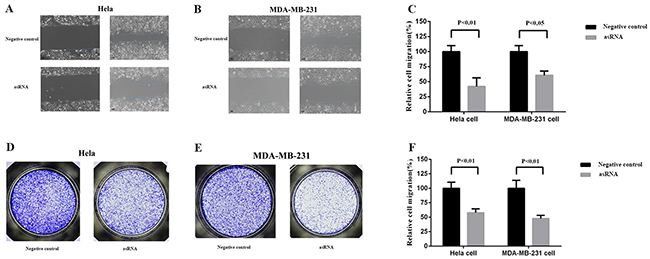 Effect of transfection of MALAT-1 asRNA vector on cell migration in Hela cell and MDA-MB-231 cell.