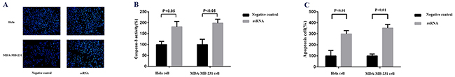 Effect of transfection of MALAT-1 asRNA vector on cell apoptosis in Hela cell and MDA-MB-231 cell.