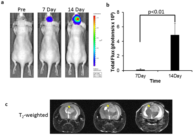 BLI and MRI monitoring of intracranial growth of U87 glioma.