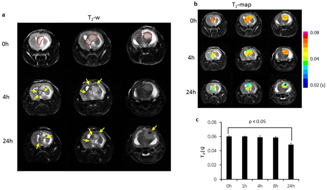 Longitudinal MRI of intratumoral biodistribution of the PS-targeted nanoprobe in orthotopic U87 glioma.