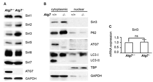 Determination of Sirt3 protein and messenger RNA levels in autophagy-intact or autophagy-defective K562 leukemia cells.