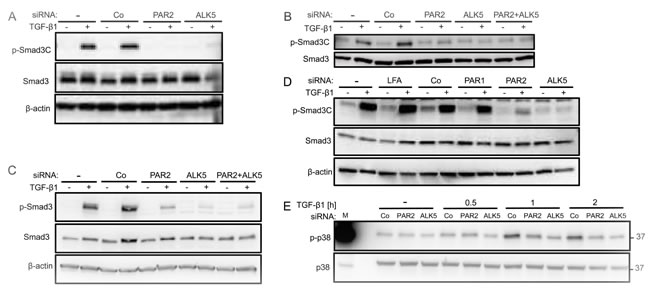 Specific inhibition of TGF-&#x3b2;1 mediated Smad3C phosphorylation following RNA interference mediated depletion of PAR2.