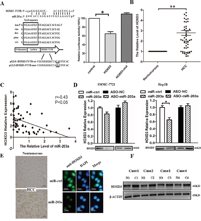 MiR-203a inhibits tumor proliferation by directly targeting HOXD3 in hepatocellular carcinoma.