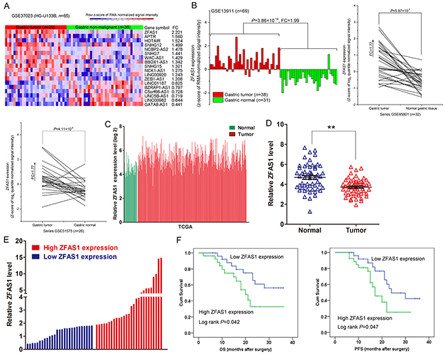 ZFAS1 expression is upregulated in NSCLC tissues and associated with poor prognosis.