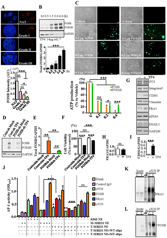 TP4 triggers TNBC cell death through FOSB induction.