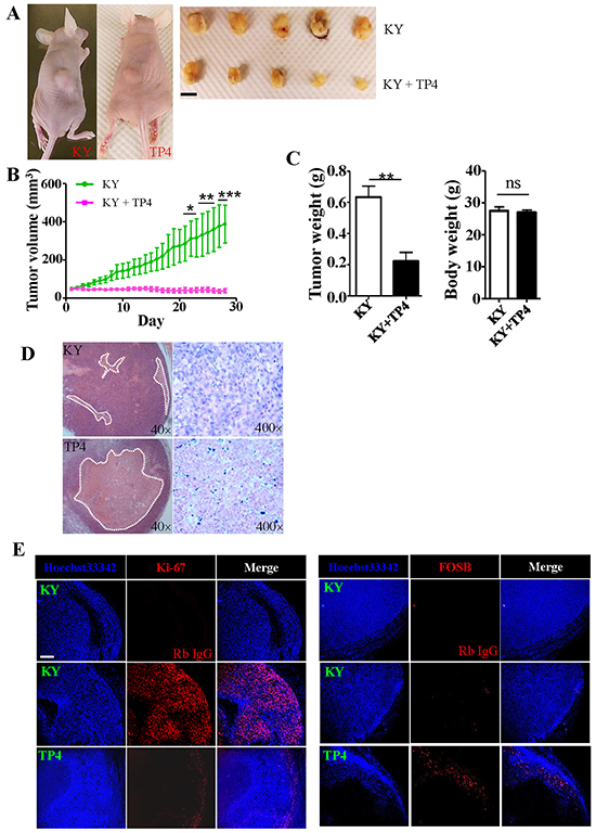 TP4 inhibits TNBC xenograft growth in nude mice.
