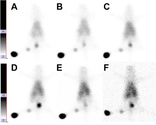 Dynamic sentinel lymphoscintigraphy at 30 min, 1 h, 2 h, 4 h, 8 h, and 16 h A&#x2013;F.
