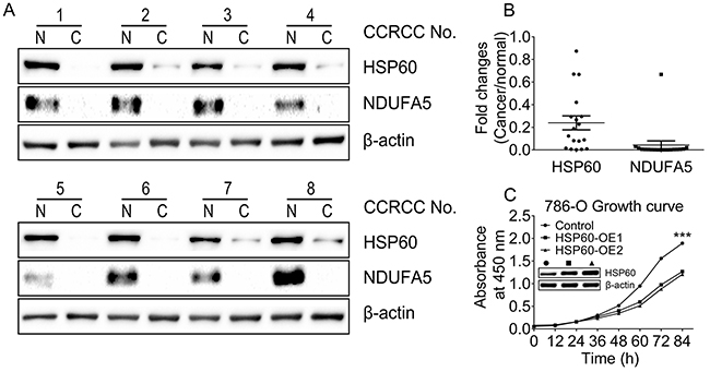 Downregulation of HSP60 and NDUFA5 in ccRCC compared to associated pericarcinous tissues.