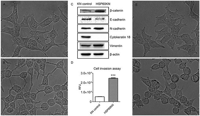 HSP60-KN-293T cells undergo the EMT process.