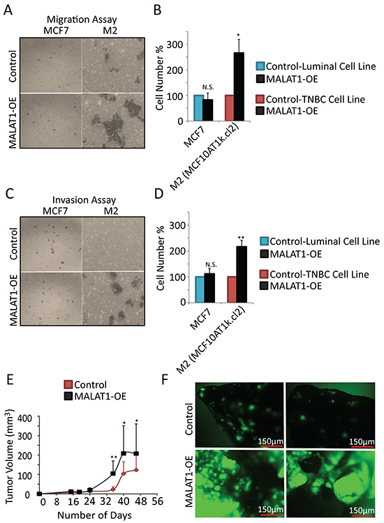 MALAT1 overexpression accelerates metastasis in TNBC cells.