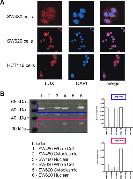 The subcellular localisation of LOX protein in colon cancer cell lines.