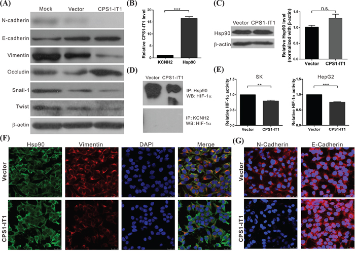 CPS1-IT1 associates with Hsp90 and inhibits the epithelial-mesenchymal transition.
