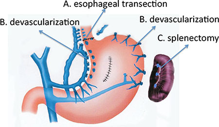 The schema showed the details of surgical procedures.