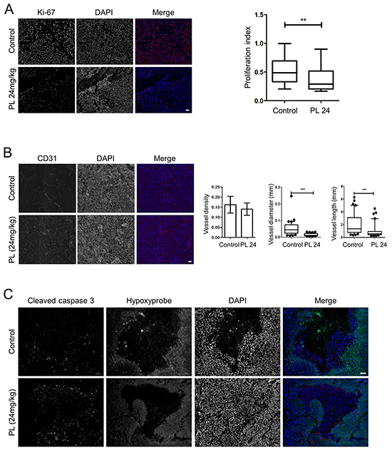 Piperlongumine decreases tumor cell proliferation and angiogenesis and increases apoptotic cell death in vivo.