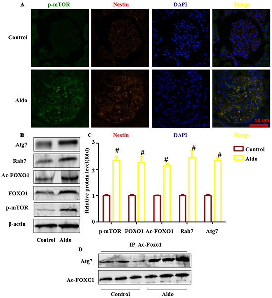 FOXO1 and acetylation of FOXO1 is associated with Aldo-induced podocyte autophagy in vivo.