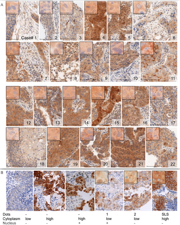 Immunohistochemical staining of LC3 and p62.