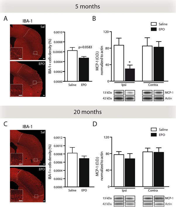 rhEPO administration limits microglial cell recruitment and reduces MCP-1 protein levels in ischemic injury.