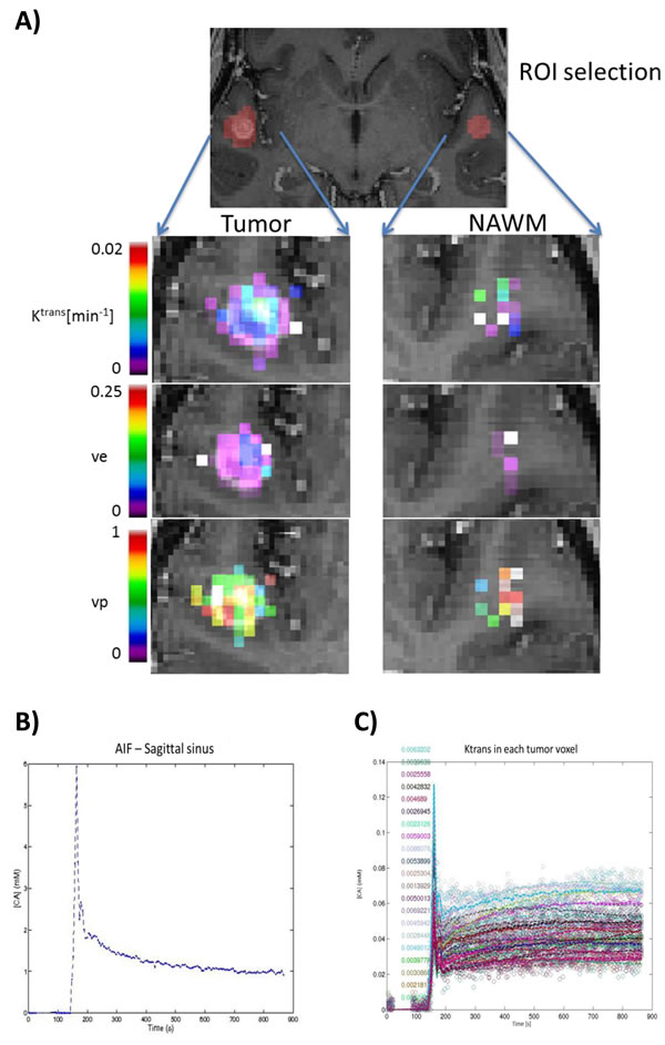 Sample parametric maps and time course of a tumor.