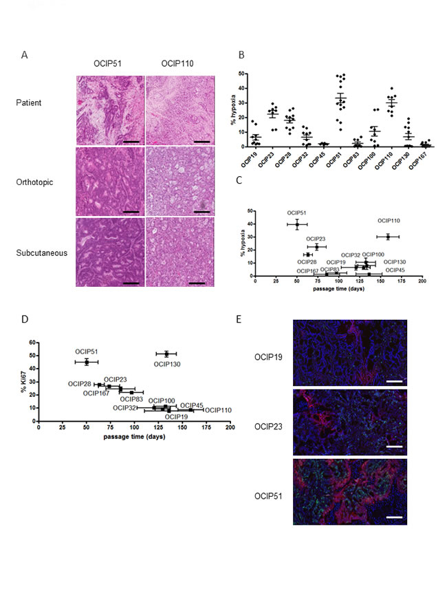 Patient-derived pancreatic xenograft models display different growth rates and hypoxia level and closely resemble the patient tumor.