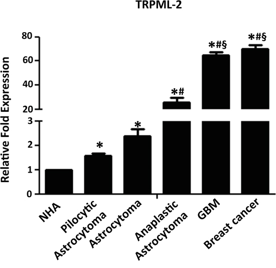 TRPML-2 mRNA expression in glioma tissues.