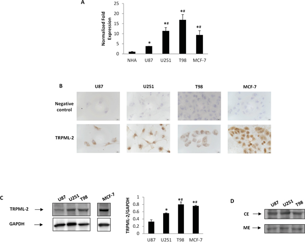 TRPML-2 mRNA and protein expression in high-grade glioma cell lines.