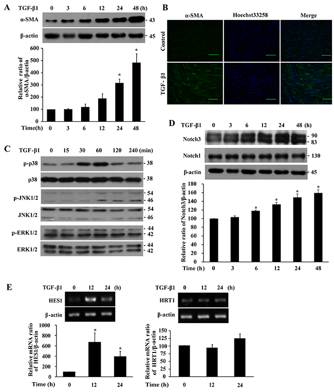 TGF-&#x03B2;1 induces differentiation, p38 and JNK1/2 phosphorylation, and Notch3 expression in IMR-90 fibroblasts.