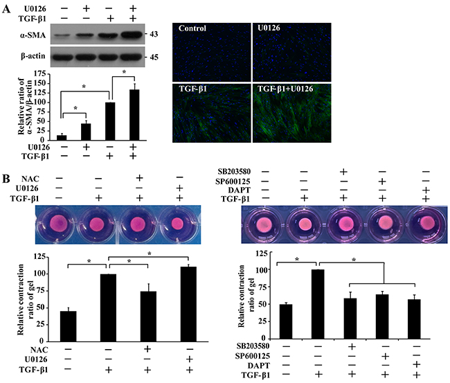 ERK1/2 inhibits TGF-&#x03B2;1-induced &#x03B1;-SMA expression and collagen gel contraction.