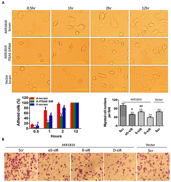 Integrin &#x03B1;5 and &#x03B4;-catenin mediate the AKR1B10-promoted cell adhesion and migration.