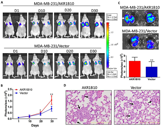 AKR1B10 promotes the lung metastasis of MDA-MB-231 cells in female nude mice.