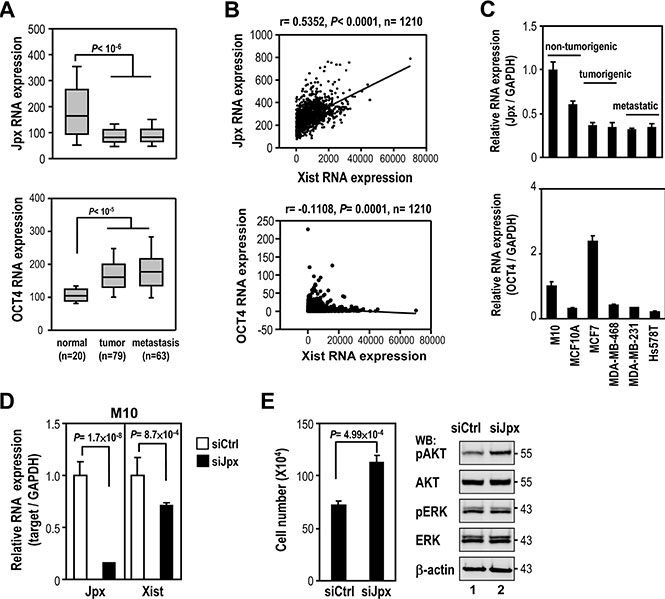 Association of Jpx in regulation of Xist expression in breast cancer.