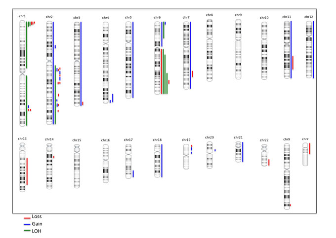 Summary ideogram showing genomic alterations in dural MZL.