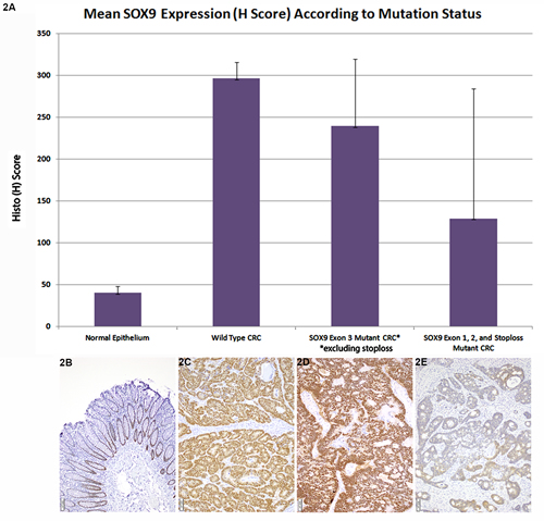 Mean SOX9 Expression (H Score) According to Mutation Status.