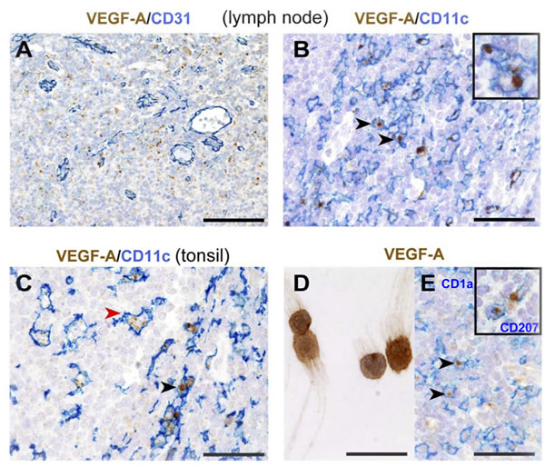 Distribution and phenotype of VEGF-A-producing cells in human reactive lymphoid tissues.