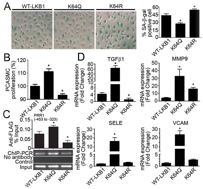 Overexpression of K64Q causes endothelial activation and promotes vascular smooth muscle cell proliferation.