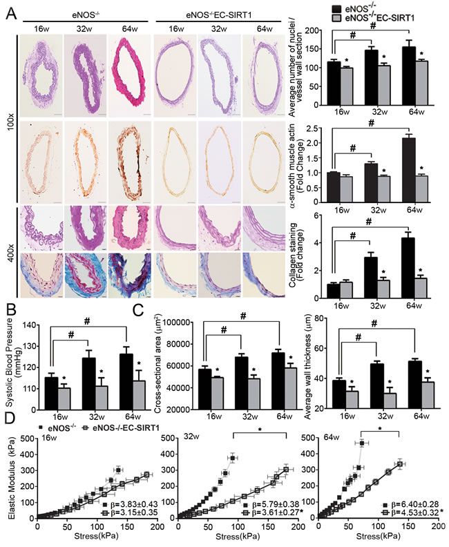 Endothelial overexpression of SIRT1 prevents adverse arterial remodeling and alleviates hypertension in eNOS-deficient mice.