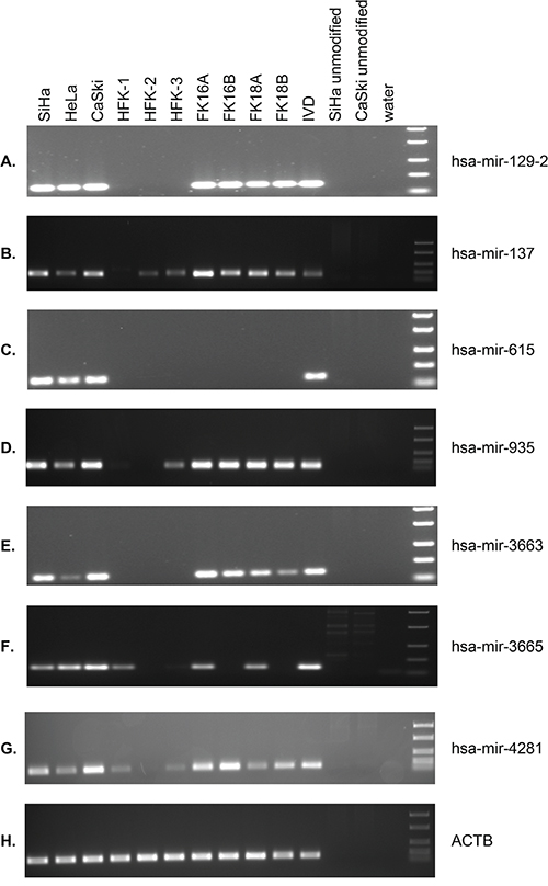 MSP results for selected miRNA genes in 3 cervical cancer cell lines (SiHa, HeLa, CaSki), primary keratinocytes (HFK) of 3 independent donors, and anchorage independent passages of 4 HPV-transformed keratinocyte cell lines (FK16A, FK16B, FK18A, and FK18B).