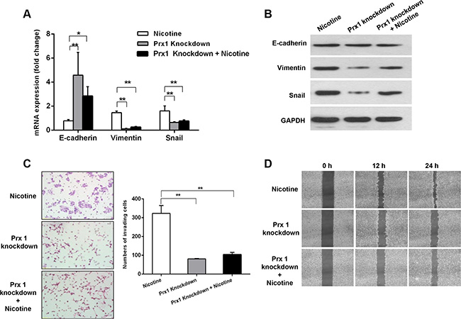 Effects of Prx1 knockdown on nicotine-induced EMT, invasion, and migration in SCC15 cells.