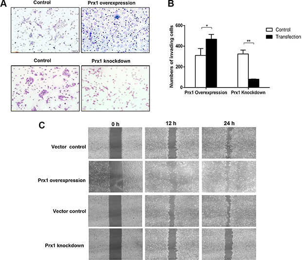 Oral squamous cell invasion and migration are altered by Prx1 in vitro.