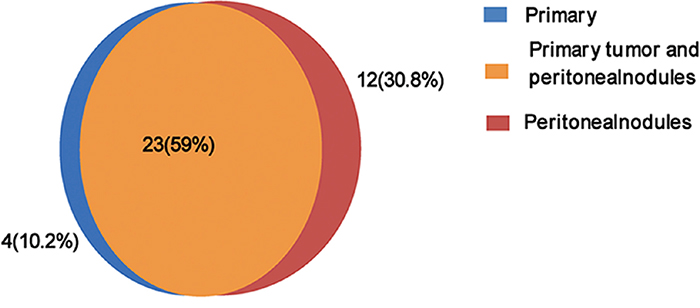 Distribution of confirmed non-synonymous somatic mutations in primary gastric cancer and peritoneal metastasis.