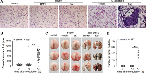 14,15-EET triggers the growth of minimal dormant metastases.