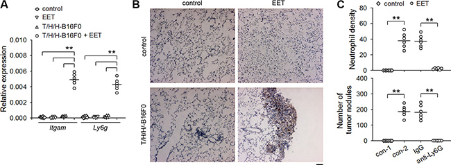 14,15-EET induces neutrophilic infiltration to promote the development of metastatic lesions.