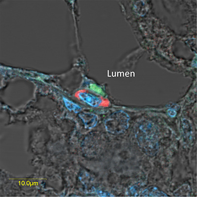Overexpressed pSTAT5 and H2AX-driven GFP are located in neighboring cells of the luminal and basal compartments, respectively, in the lobuloalveolar structure of the pregnant mammary gland.