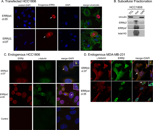 Endogenous ERR&#x03B2;2 localizes to the cytosol and centrosomes.