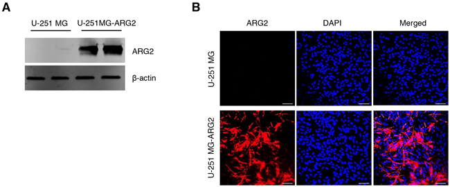 Characterization of the stable cell line U-251 MG-ARG2.