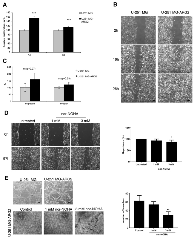 Effect of stable overexpression of ARG2 on proliferation, migration and tube formation of U251 MG cells.